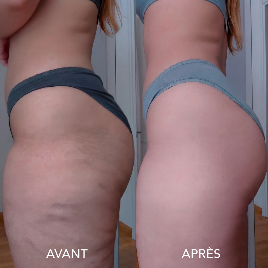 Huile Anti-Cellulite SELYNE