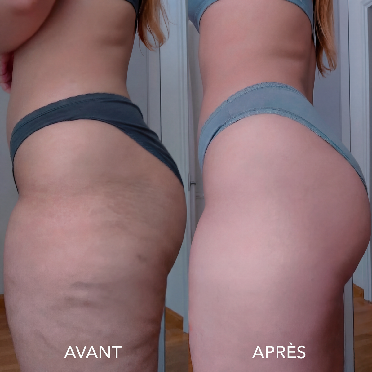 Huile Anti-Cellulite SELYNE
